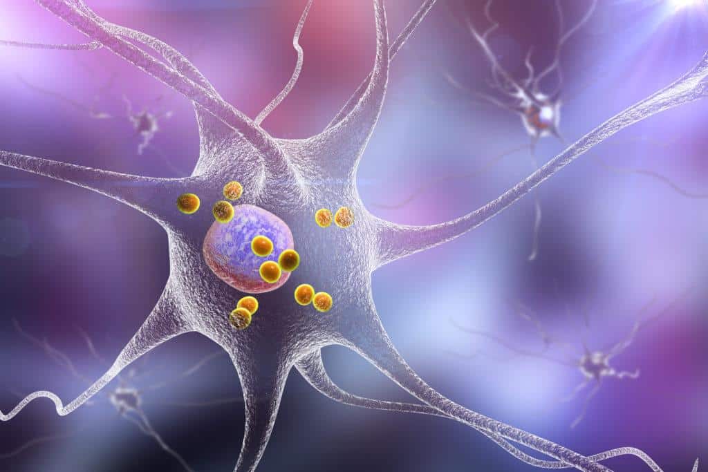 parkinsonin-tauti-ja-taudin-oireet-suomen-seniorihoiva